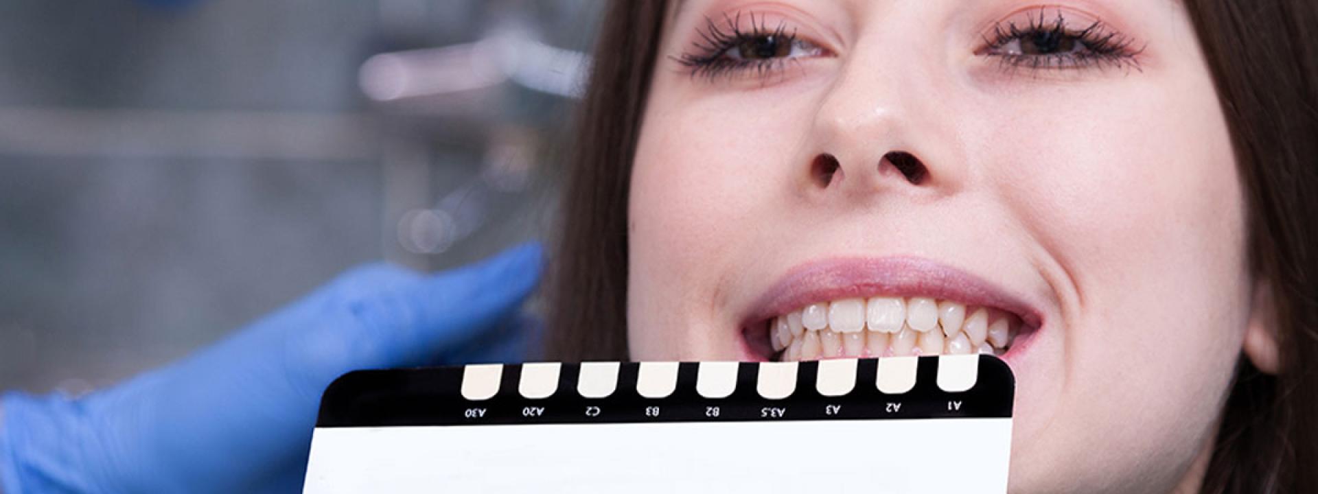 Teeth color checking Teeth color checking