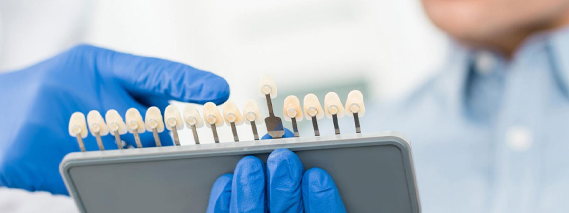 Dental Implant option Dental Implant option